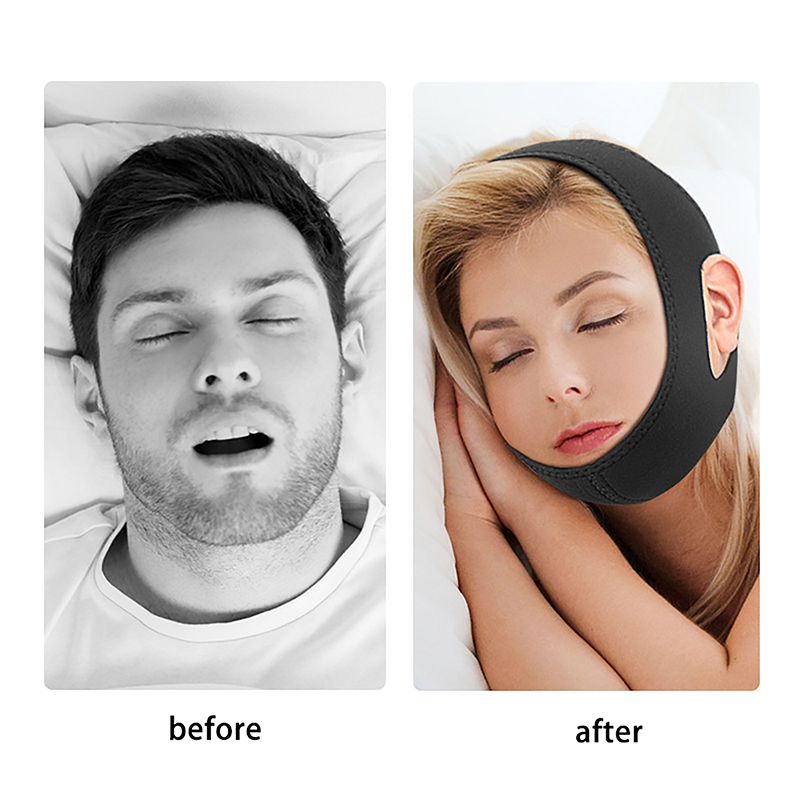 Cinturino Antirussamento Regol - Anti Snore Chin Strap Adjustable recensione e prezzo